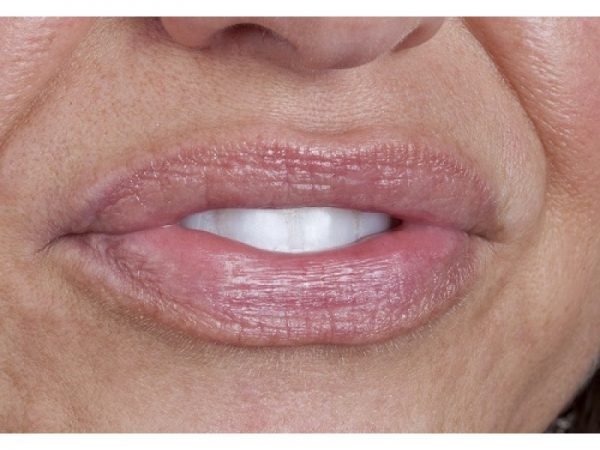 go_step_5_final-800×600