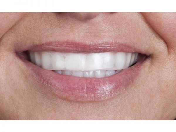 go_step_6_final-800×600