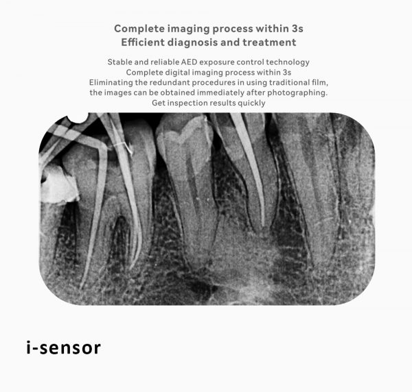 I SENSOR MAIN PHOTO 4