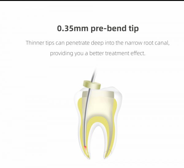fig fip main photo 7